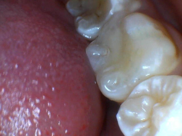 After