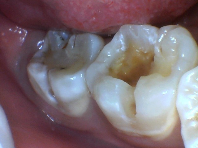 Before